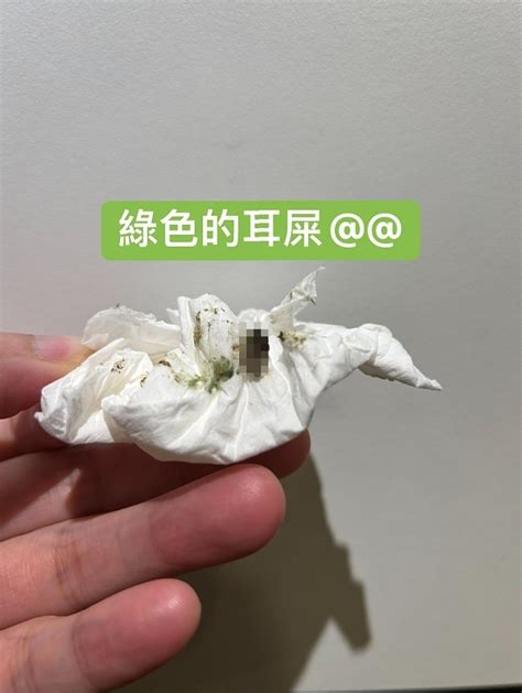 左耳癢時辰|【左耳癢時辰】左耳癢好運降！不同時辰預示有好運到！